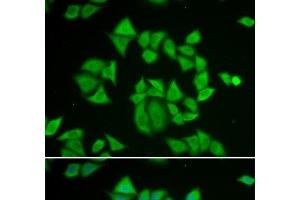 Immunofluorescence analysis of A549 cells using GSTM2 Polyclonal Antibody (GSTM2 抗体)