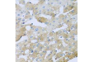 Immunohistochemistry of paraffin-embedded human liver injury using AP1M2 antibody. (AP1m2 抗体  (AA 164-423))