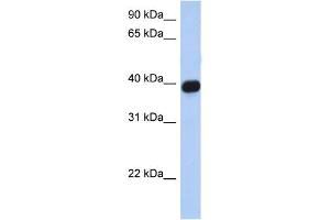 WB Suggested Anti-CXCR6 Antibody Titration:  0. (CXCR6 抗体  (N-Term))