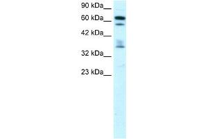 WB Suggested Anti-ZNF512 Antibody Titration: 0. (ZNF512 抗体  (Middle Region))