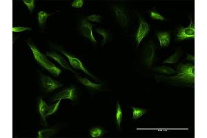 Immunofluorescence of purified MaxPab antibody to MAP7 on HeLa cell. (MAP7 抗体  (AA 1-749))