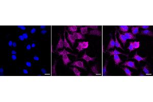 anti-Glutathione Peroxidase 1 (GPX1) antibody
