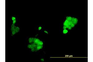 Immunofluorescence of monoclonal antibody to PGR on A-431 cell. (Progesterone Receptor 抗体  (AA 1-110))