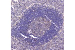 IHC testing of FFPE rat spleen tissue with RAB27A antibody at 1ug/ml. (RAB27A 抗体)