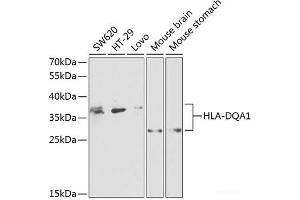 Western blot analysis of extracts of various cell lines using HLA-DQA1 Polyclonal Antibody at dilution of 1:1000. (HLA-DQA1 抗体)