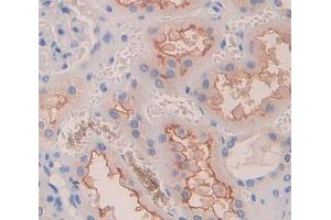 IHC-P analysis of Human Tissue, with DAB staining. (Dysferlin 抗体  (AA 1-479))