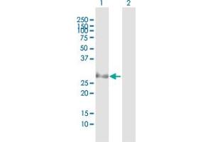 Western Blotting (WB) image for anti-Proteasome (Prosome, Macropain) Subunit, beta Type, 8 (Large Multifunctional Peptidase 7) (PSMB8) (AA 1-272) antibody (ABIN519382)