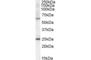 Western Blotting (WB) image for anti-Collagen, Type IV, alpha 3 (Goodpasture Antigen) Binding Protein (COL4A3BP) (AA 662-672) antibody (ABIN293420) (COL4A3BP 抗体  (AA 662-672))