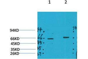 Western Blot (WB) analysis of 1) Mouse Brain Tissue, 2)Rat Brain Tissue with GABA A Receptor alpha4 Rabbit Polyclonal Antibody diluted at 1:2000. (GABRA4 抗体)