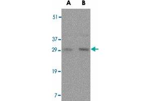 Western blot analysis of TNFSF11 in rat liver tissue lysate with TNFSF11 polyclonal antibody  at (A) 0. (RANKL 抗体  (Internal Region))