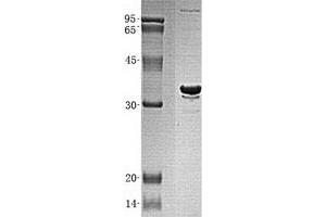 Validation with Western Blot