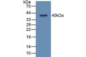 Figure. (TP53TG5 抗体  (AA 190-262))