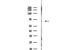 Western blot analysis of lysates from COLO205 cells(heat-shock,45 min treatment), using Phospho-Chk2 (Thr387) Antibody at 1/1000 dilution.