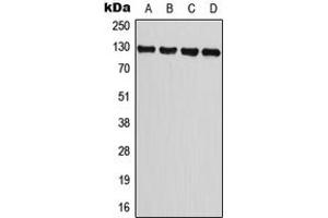 Western blot analysis of TRPM8 expression in A549 (A), PC3 (B), NIH3T3 (C), H9C2 (D) whole cell lysates.