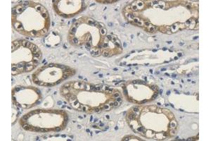 DAB staining on IHC-P; Samples: Human Kidney Tissue (FGF10 抗体  (AA 38-208))
