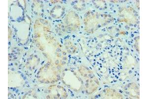 Immunohistochemistry (IHC) image for anti-SMAD Family Member 9 (SMAD9) (AA 1-300) antibody (ABIN7160251)