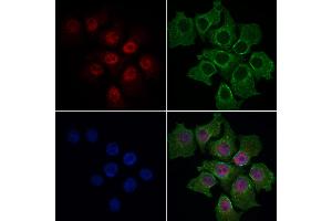 ABIN6264703 and ABIN6269101 staining HepG2 cells by IF/ICC. (Retinoblastoma 1 抗体  (C-Term))