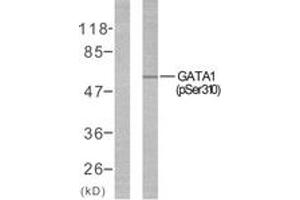Western blot analysis of extracts from COS7 cells treated with EPO, using GATA1 (Phospho-Ser310) Antibody. (GATA1 抗体  (pSer310))