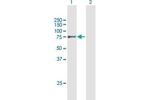 Western Blotting (WB) image for anti-Collagen, Type IV, alpha 3 (Goodpasture Antigen) Binding Protein (COL4A3BP) (AA 1-598) antibody (ABIN948882)