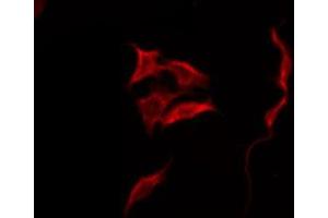 anti-Sodium Channel, Voltage-Gated, Type IV, beta Subunit (SCN4B) (C-Term) antibody