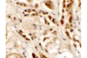 Immunohistochemistry of SIGLEC15 in human kidney tissue with SIGLEC15 antibody at 2.
