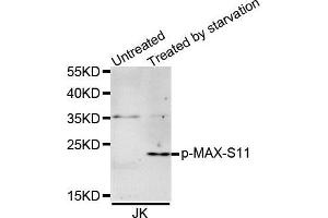 Western Blotting (WB) image for anti-MYC Associated Factor X (MAX) (pSer11) antibody (ABIN3019515) (MAX 抗体  (pSer11))