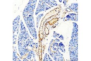 IHC analysis of CD31 using anti-CD31 antibody (ABIN5692990).