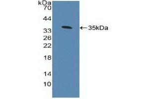 Detection of Recombinant AhR, Human using Polyclonal Antibody to Aryl Hydrocarbon Receptor (AhR) (Aryl Hydrocarbon Receptor 抗体  (AA 128-399))