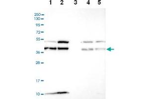 Western blot analysis of Lane 1: RT-4 Lane 2: U-251 MG Lane 3: Human Plasma Lane 4: Liver Lane 5: Tonsil with C6orf47 polyclonal antibody ( Cat # PAB28310) at 1:100-1:250 dilution. (C6orf47 抗体)