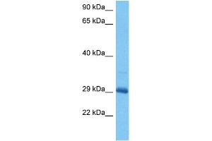 Host:  Mouse  Target Name:  DLX5  Sample Tissue:  Mouse Skeletal Muscle  Antibody Dilution:  1ug/ml (DLX5 抗体  (C-Term))