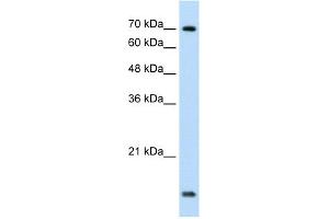 WB Suggested Anti-UBE2L3 Antibody Titration:  1. (UBE2L3 抗体  (C-Term))