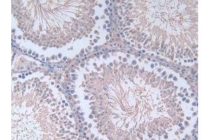 Detection of FN in Rat Testis Tissue using Polyclonal Antibody to Fibronectin (FN) (Fibronectin 抗体  (AA 355-558))