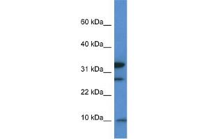 WB Suggested Anti-Mrps33 Antibody Titration: 1.