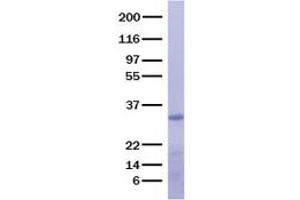 Validation with Western Blot (CPB1 蛋白)