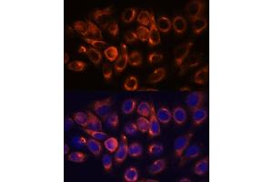 Immunofluorescence analysis of HeLa cells using  antibody (ABIN7265713) at dilution of 1:100. (ATL2 抗体  (AA 390-470))