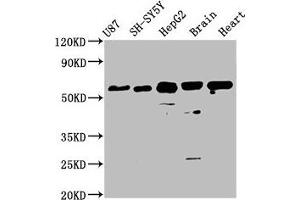 Western Blot Positive WB detected in: U87 whole cell lysate, SH-SY5Y whole cell lysate, HepG2 whole cell lysate, Mouse brain tissue, Rat heart tissue All lanes: CPNE7 antibody at 3. (CPNE7 抗体  (AA 254-393))