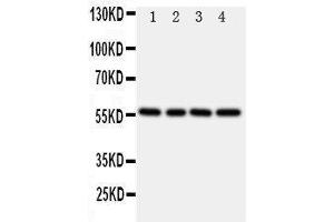 Anti-TXNRD2 antibody, Western blotting Lane 1: Rat Kidney Tissue Lysate Lane 2: Rat Ovary Tissue Lysate Lane 3: Rat Liver Tissue Lysate Lane 4: SMMC Cell Lysate (TXNRD2 抗体  (C-Term))
