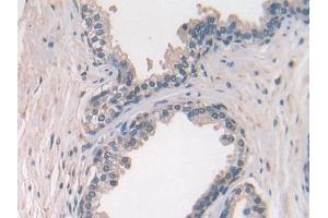 Used in DAB staining on fromalin fixed paraffin-embedded Ovary tissue (CCL27 抗体  (AA 25-112))