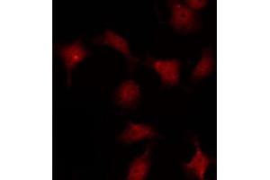 ABIN6267254 staining COS7 by IF/ICC. (ABL1 抗体  (pTyr245))
