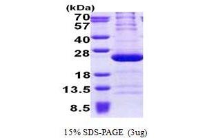 SDS-PAGE (SDS) image for Ribosomal Protein L11 (RPL11) (AA 1-178) protein (His tag) (ABIN5853104)