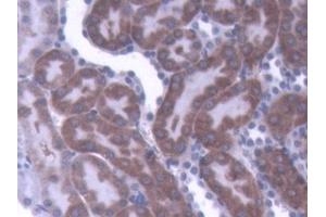 DAB staining on IHC-P; Samples: Rat Kidney Tissue (IL-1 beta 抗体  (AA 117-268))