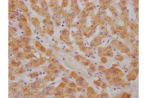 IHC image of ABIN7127317 diluted at 1:100 and staining in paraffin-embedded human liver tissue performed on a Leica BondTM system. (Recombinant ABAT 抗体)