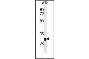 Western blot analysis of HCCS / CCHL Antibody (Center) in WiDr cell line lysates (35ug/lane). (HCCS 抗体  (Middle Region))