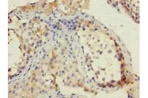 Immunohistochemistry of paraffin-embedded human testis tissue using ABIN7151292 at dilution of 1:100 (TRIP12 抗体  (AA 1-240))
