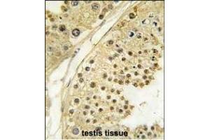 Formalin-fixed and paraffin-embedded human testis tissue reacted with STK12 Antibody (N-term) (ABIN391353 and ABIN2841374) , which was peroxidase-conjugated to the secondary antibody, followed by DAB staining. (Aurora-B (ARK/STK12) (AA 6-35), (N-Term) 抗体)