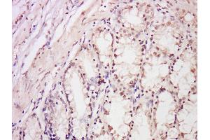 Formalin-fixed and paraffin embedded rat intestine labeled with Anti-DDB2 Polyclonal Antibody, Unconjugated  at 1:300 followed by conjugation to the secondary antibody and DAB staining. (DDB2 抗体  (AA 201-300))