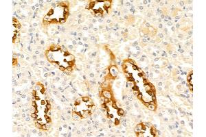 anti-C1q and Tumor Necrosis Factor Related Protein 3 (C1QTNF3) (N-Term) antibody