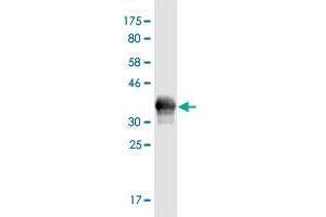 Western Blot detection against Immunogen (37.