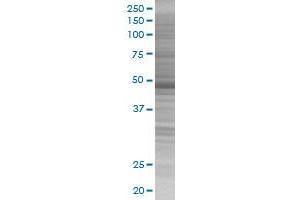 Western Blotting (WB) image for KRT17 293T Cell Transient Overexpression Lysate(Denatured) (ABIN1332458)