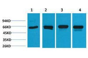 Western Blotting (WB) image for anti-Heat Shock 60kDa Protein 1 (Chaperonin) (HSPD1) antibody (ABIN3181507) (HSPD1 抗体)